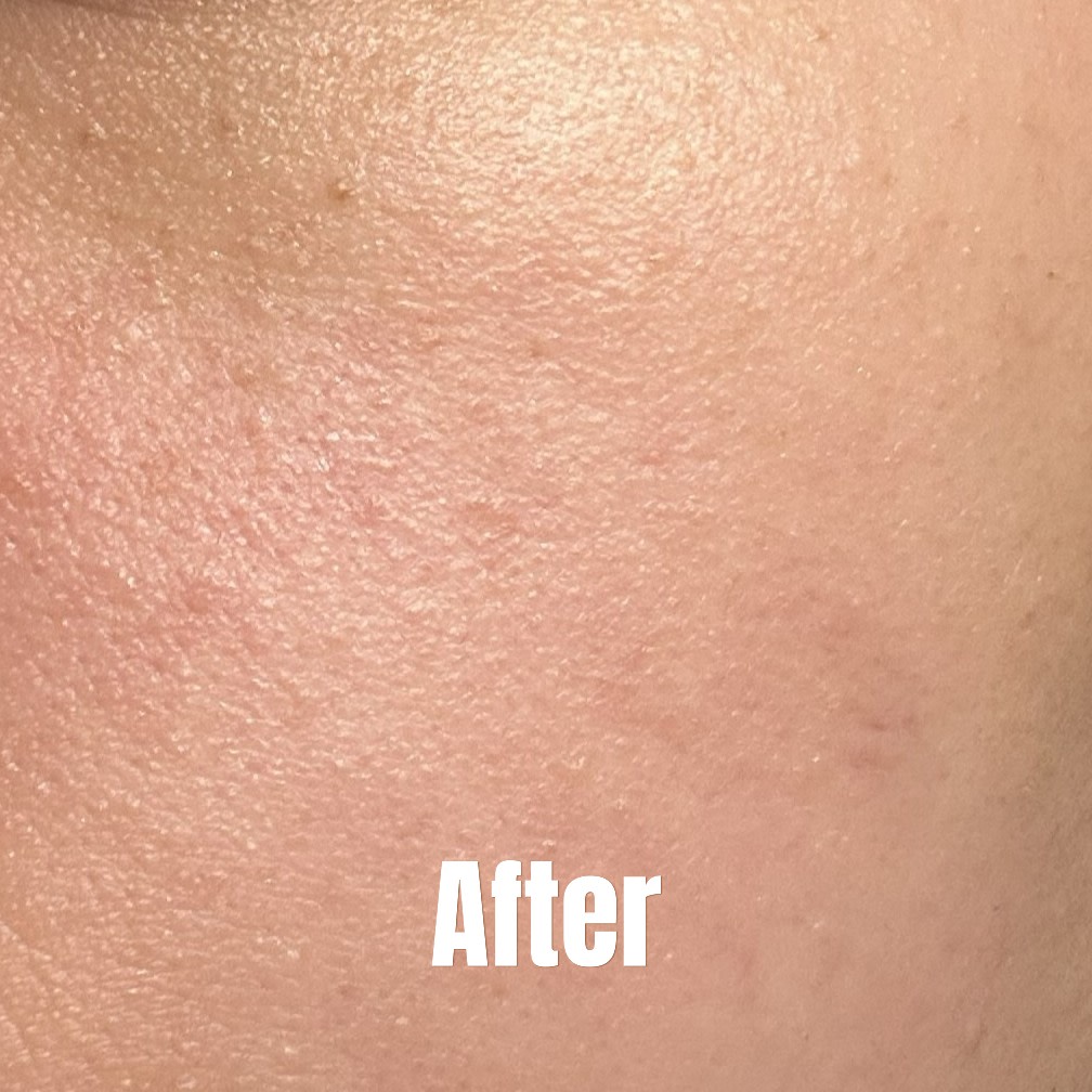 Immediately after application.