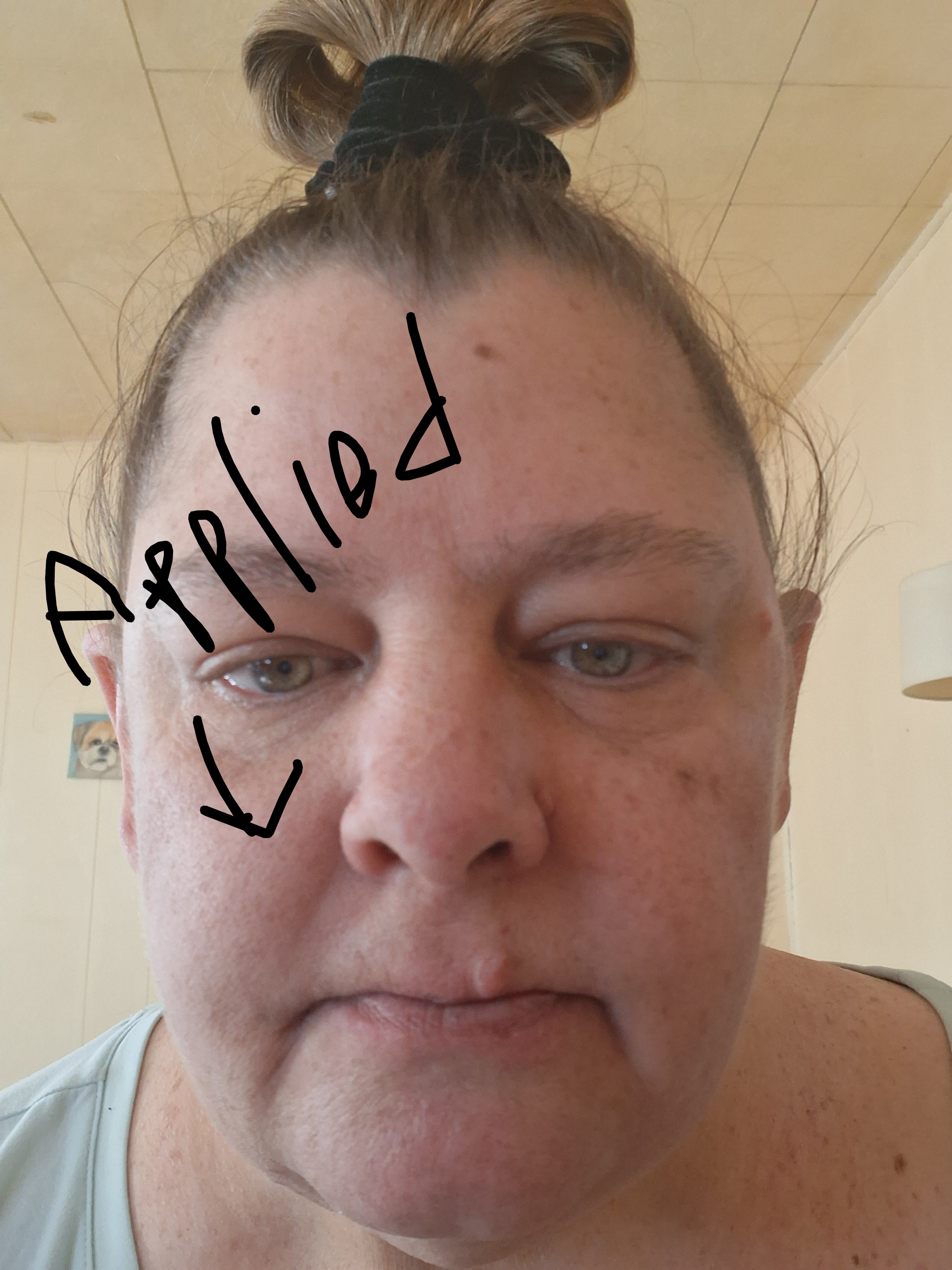 Applied to right side of face