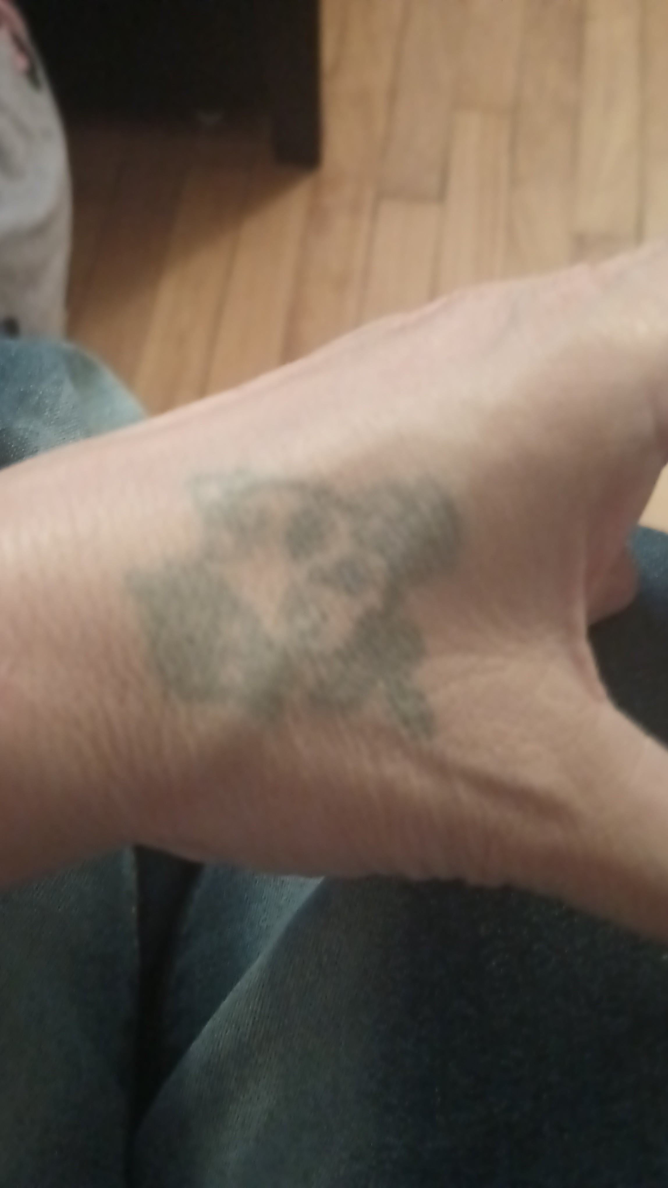 Effective even over a dark tattoo