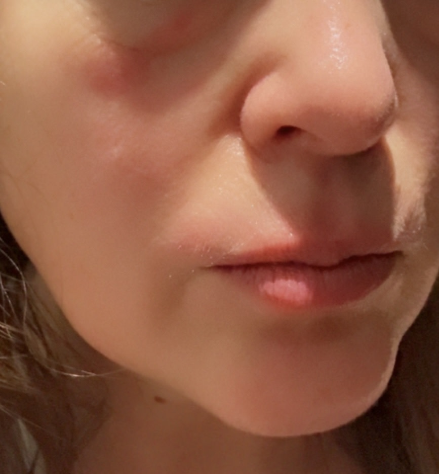 Reaction from using product