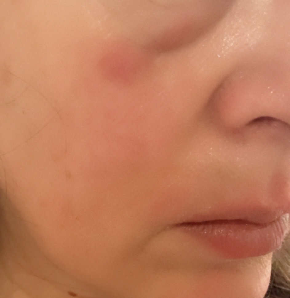 Reaction for using product