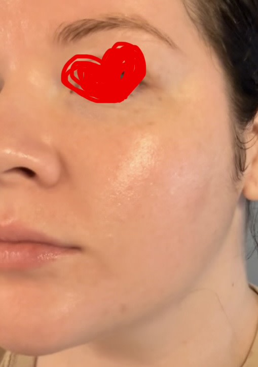 Literally glowing!!!