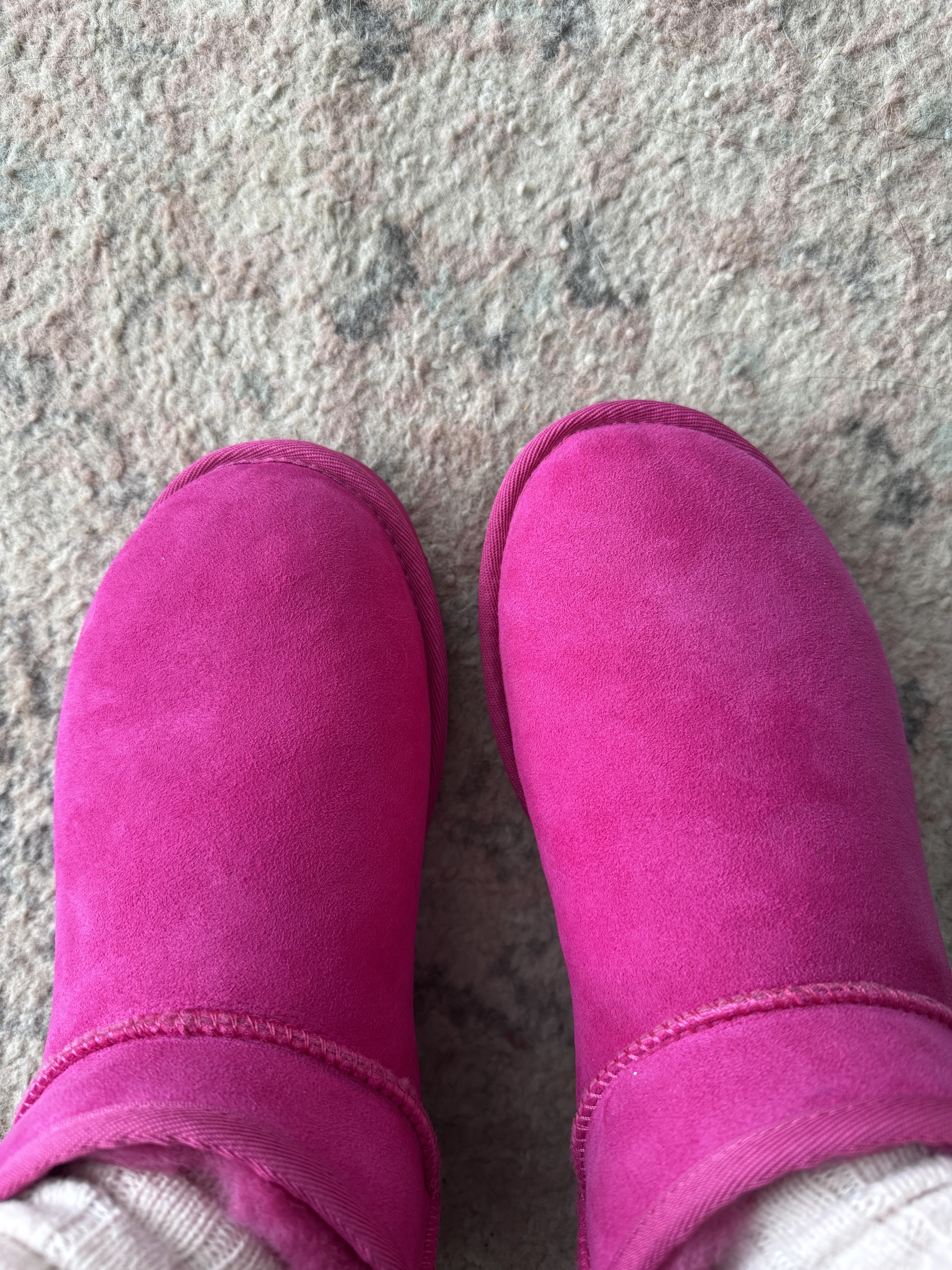 Look at the right shoe, looks poorly made