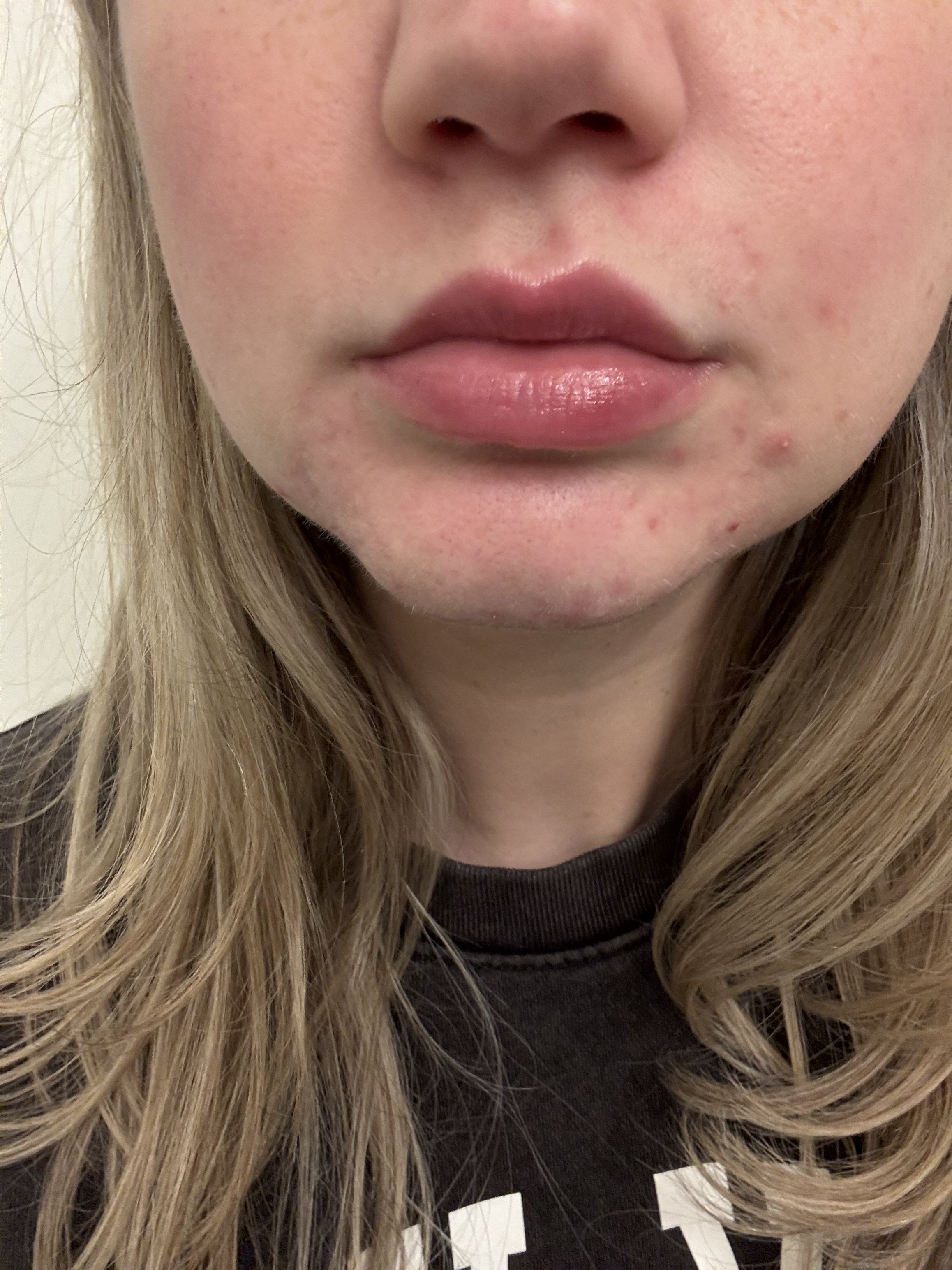 Lip balm on lips