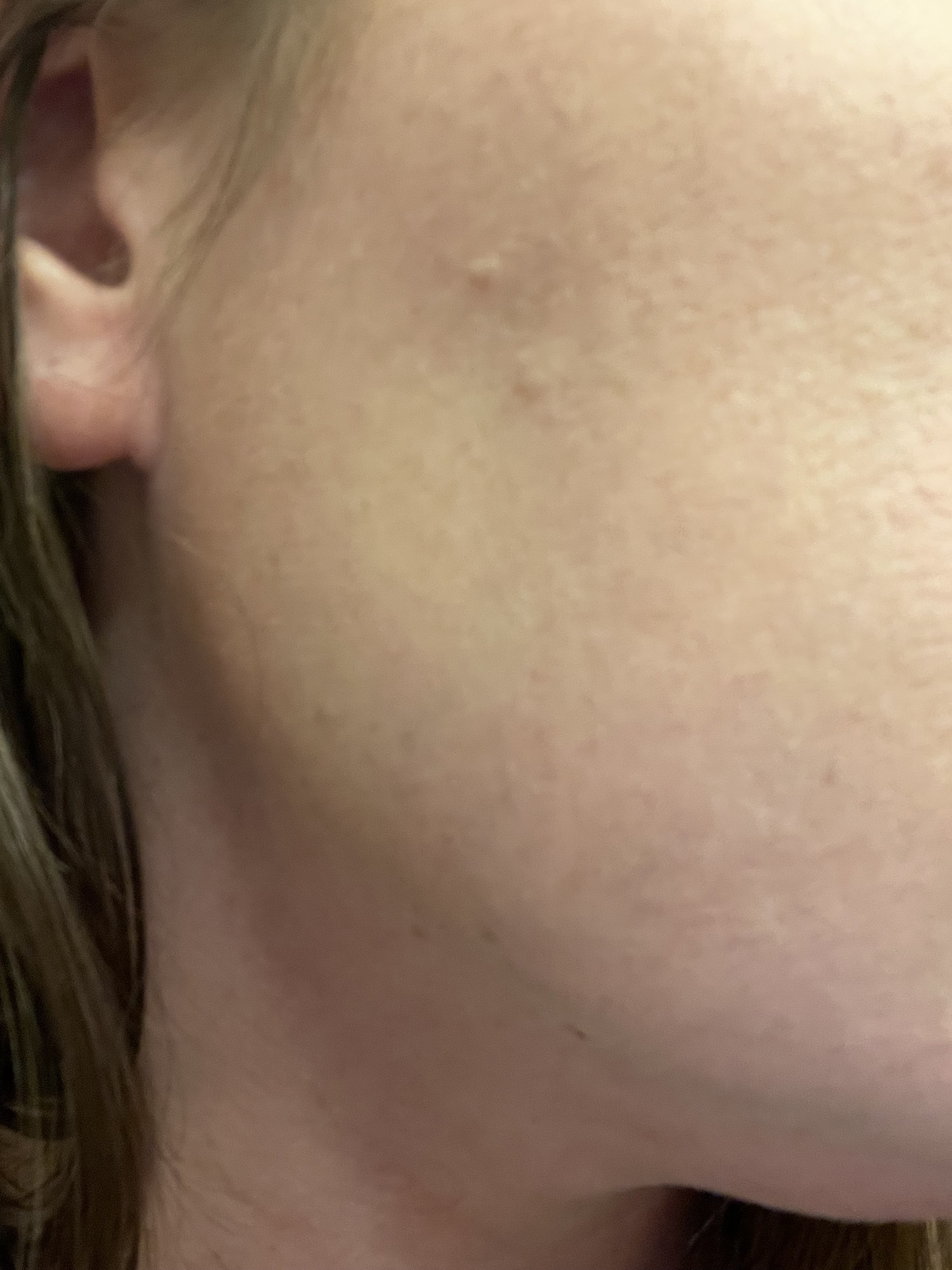 After Application