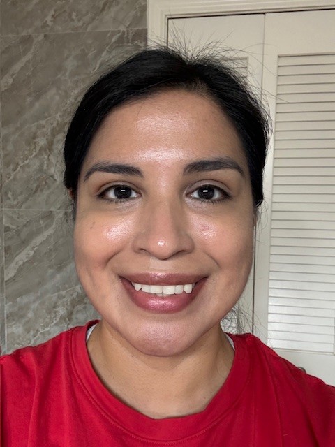 Foundation on its own. No concealer or other product applied yet.