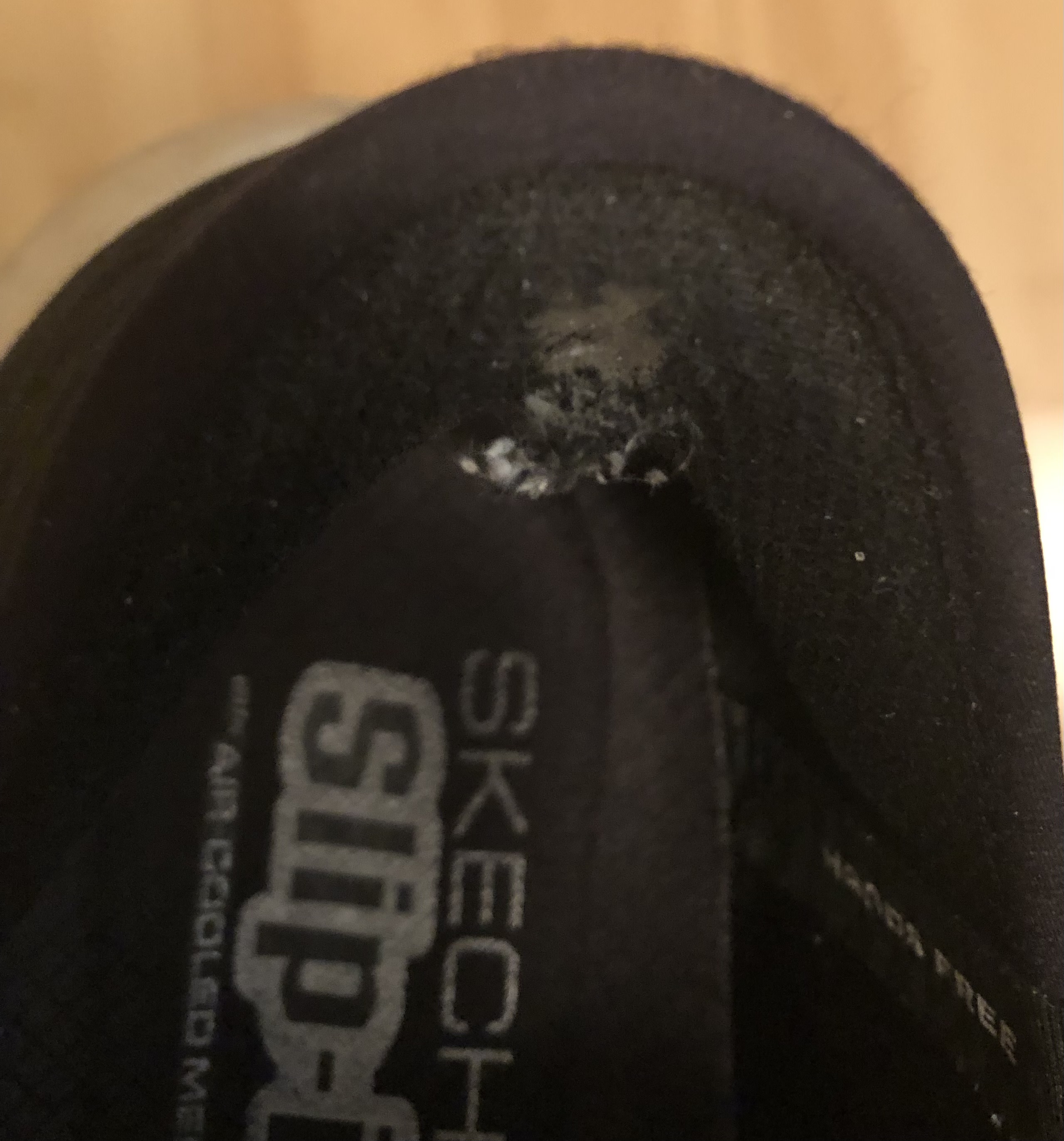 Both shoes - stepfailures