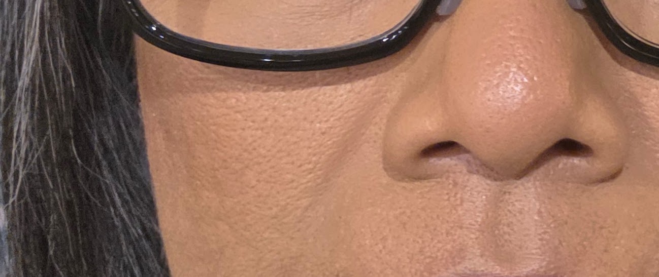 Makes skin look crinkley