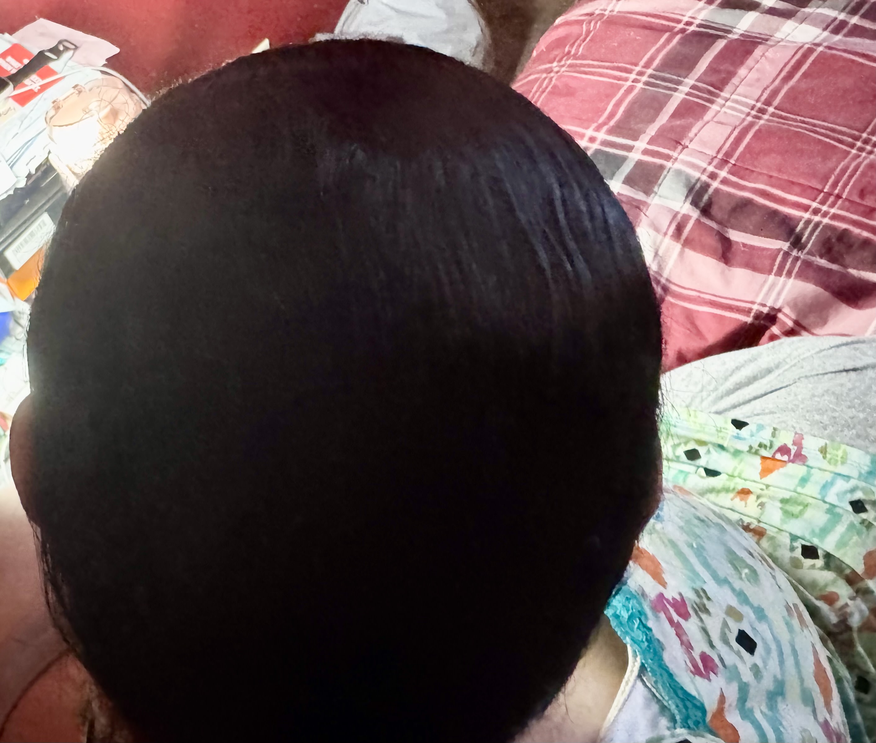 No more scalp spots showing,