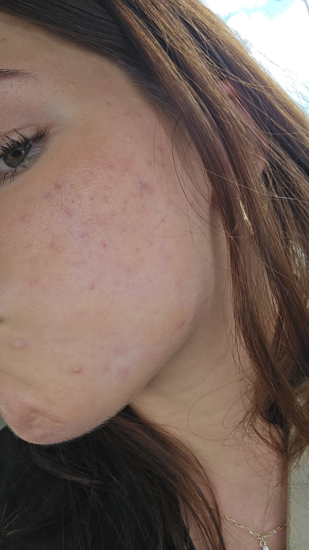 Same exact shade that used to match me