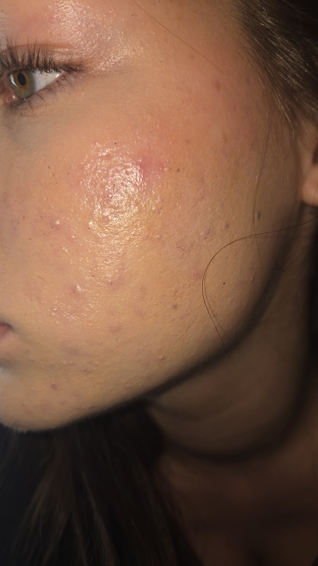 One of the lightest shades literally turning orange