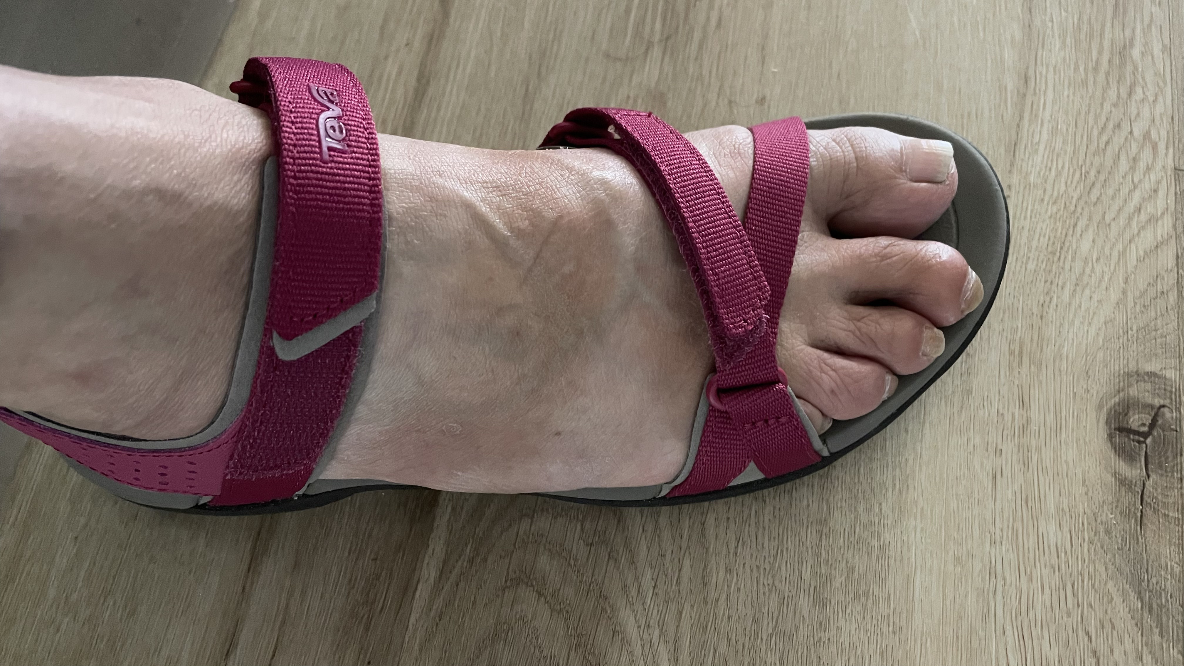 notice ankle strap