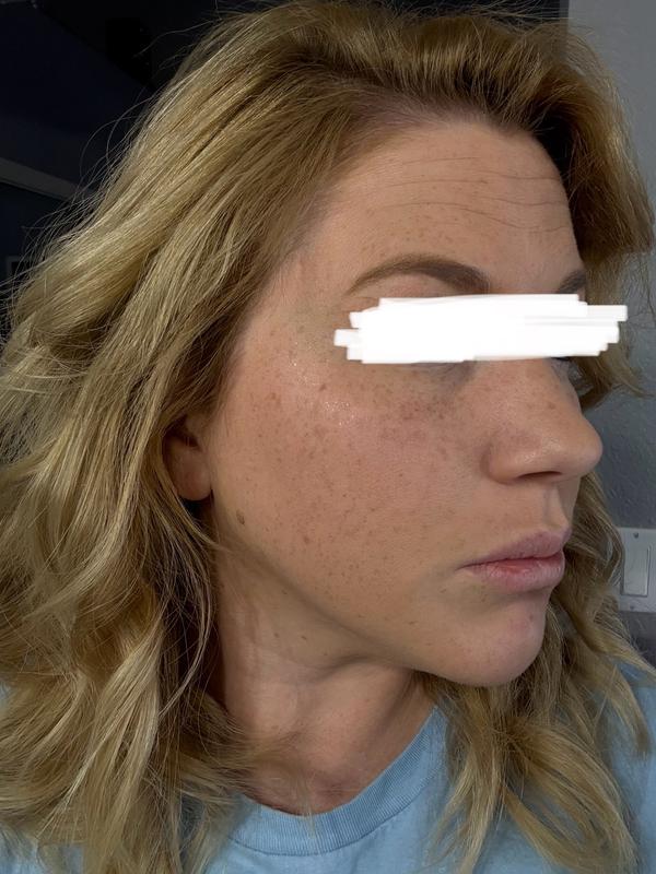 Customer carousel item 11.