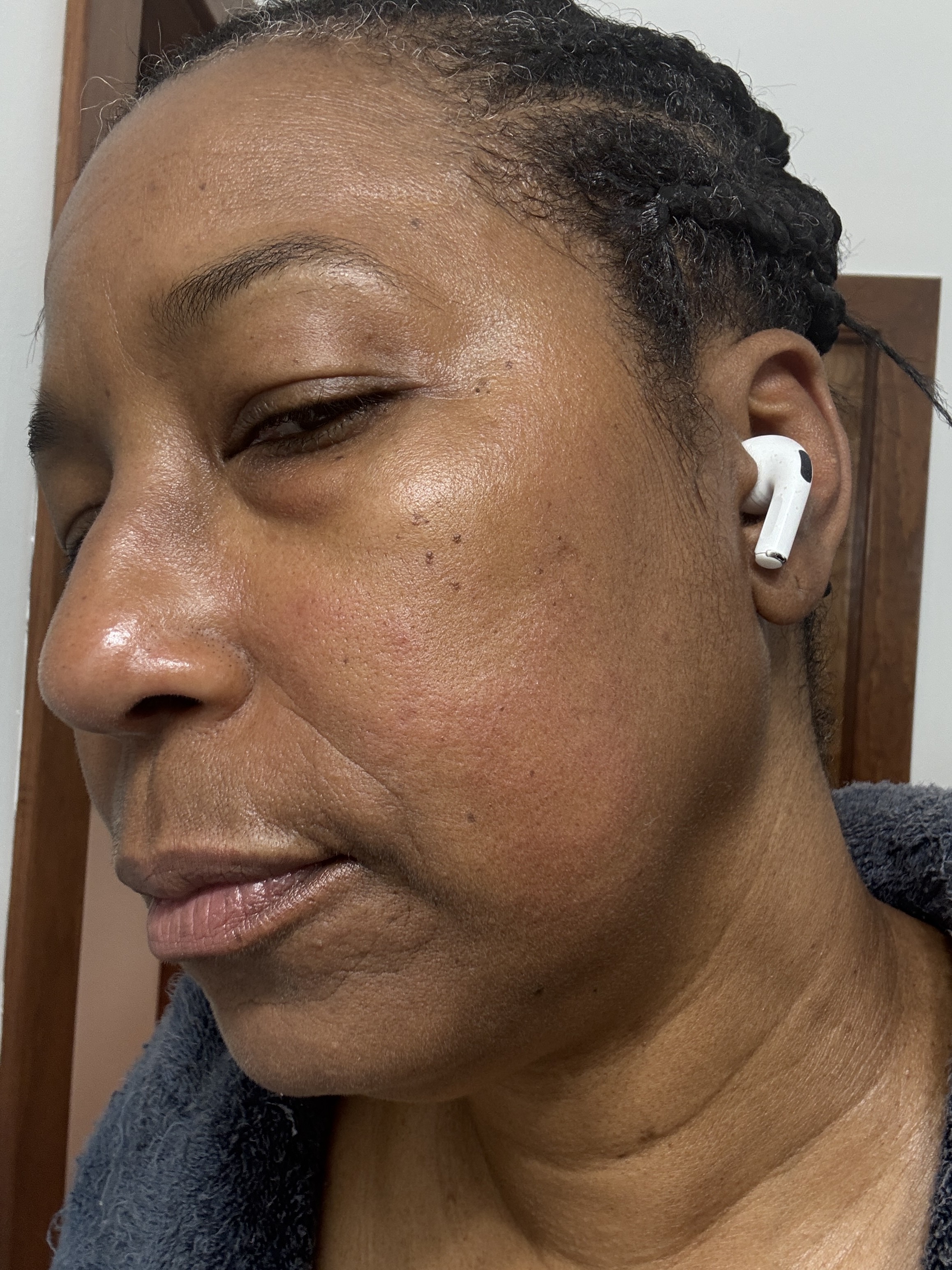 New Formula. Allergic Reaction. They Knew.