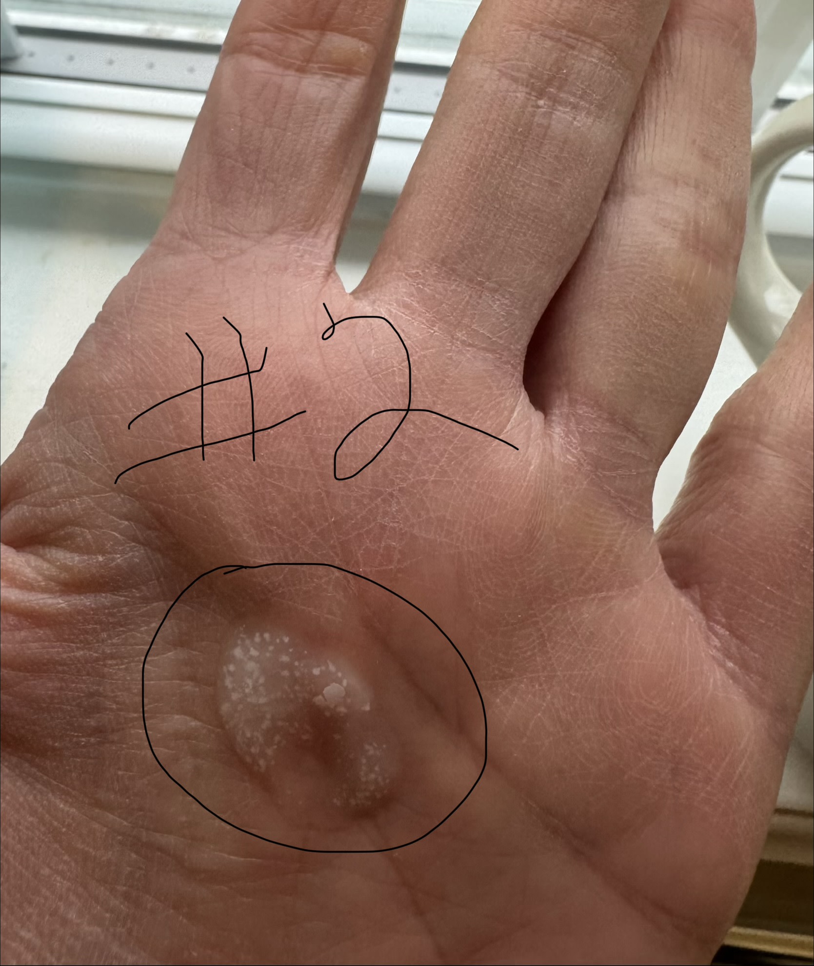 White chunks in shampoo