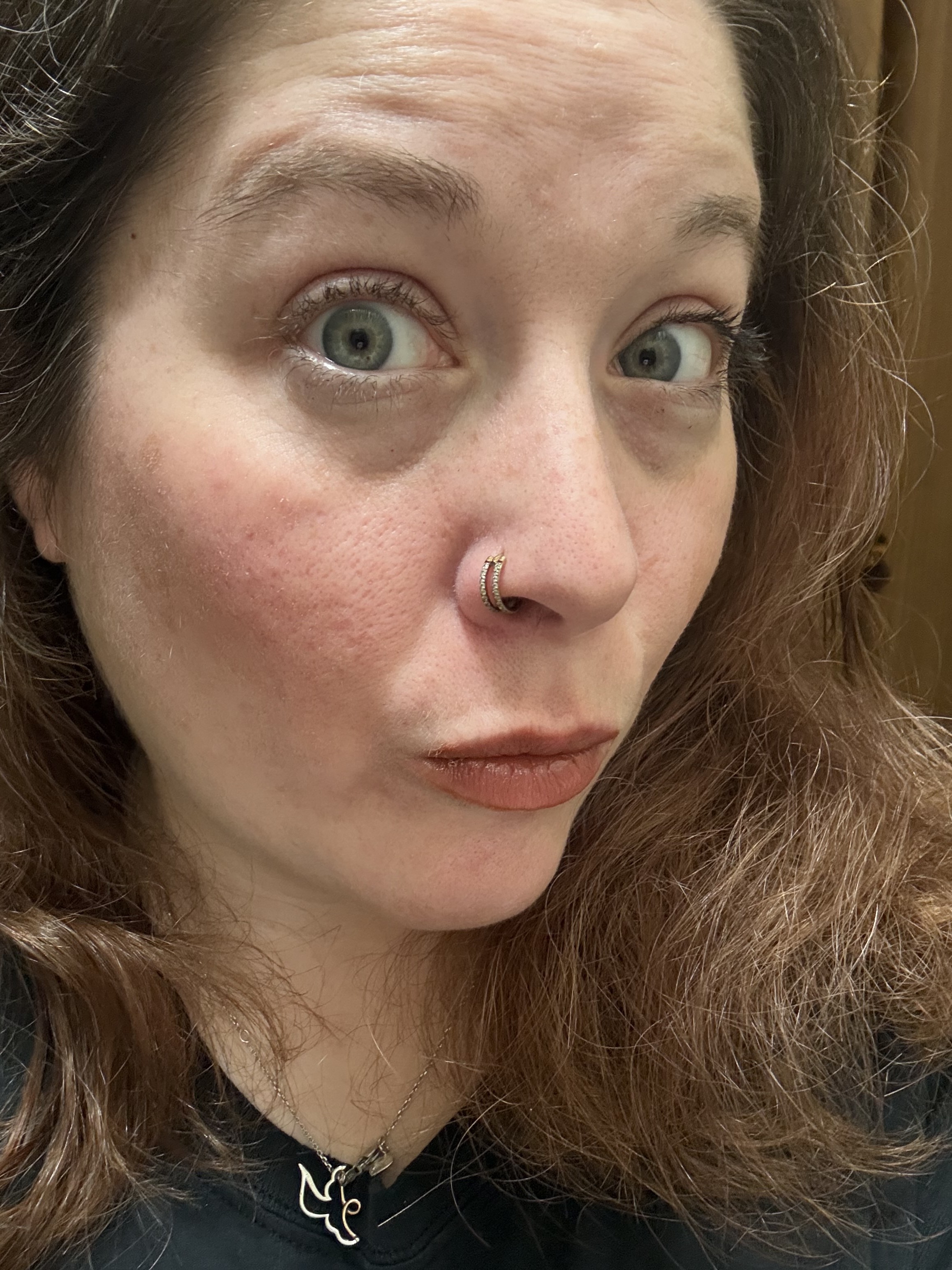 On my lips and cheek