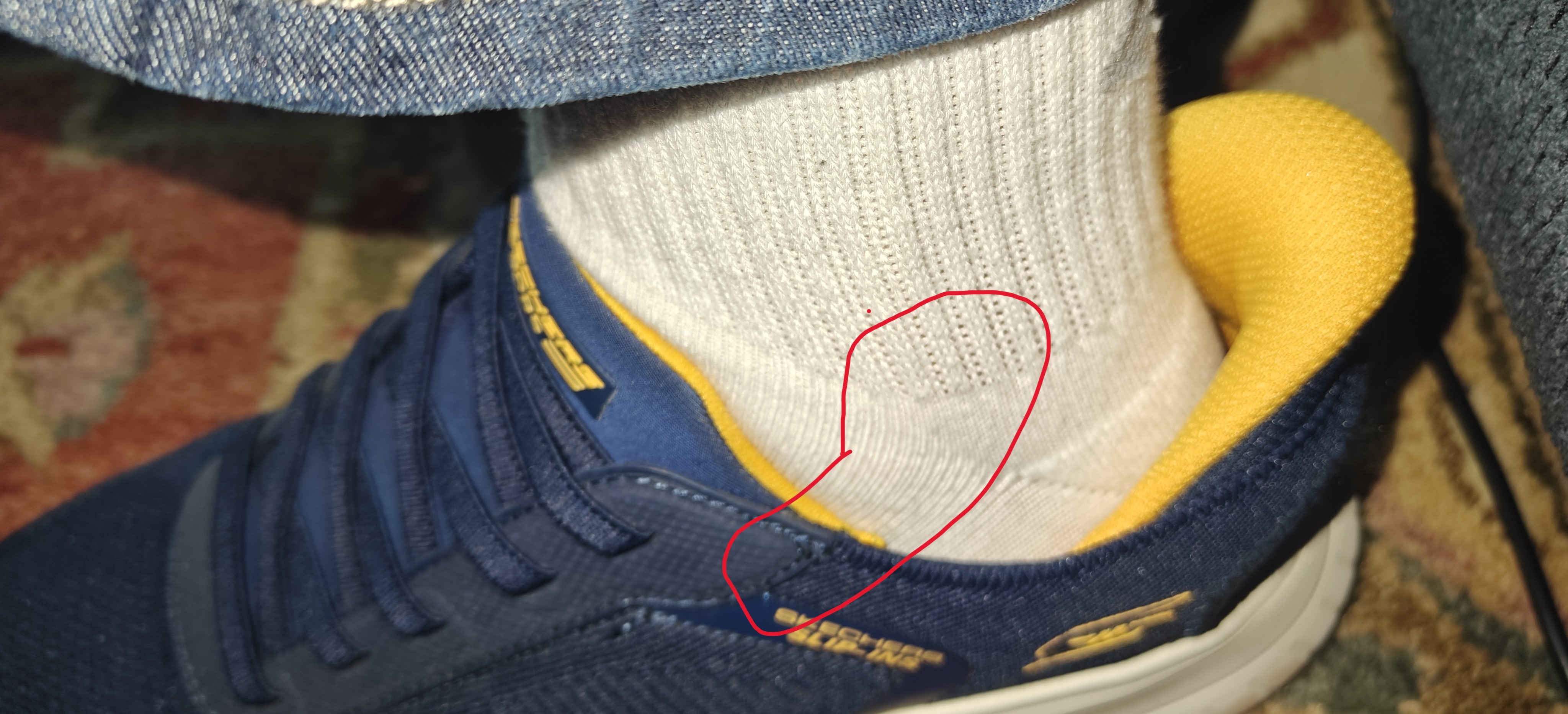 Sharp edge on seam rubs on ankle bone