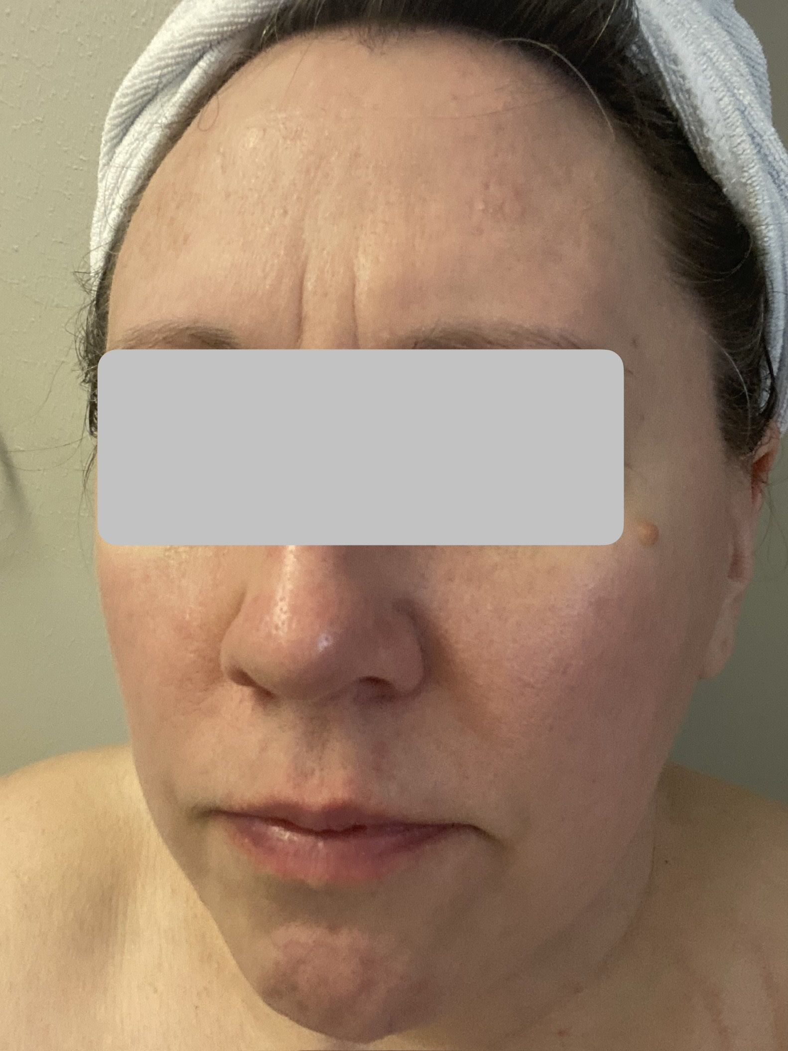 April 7 - before