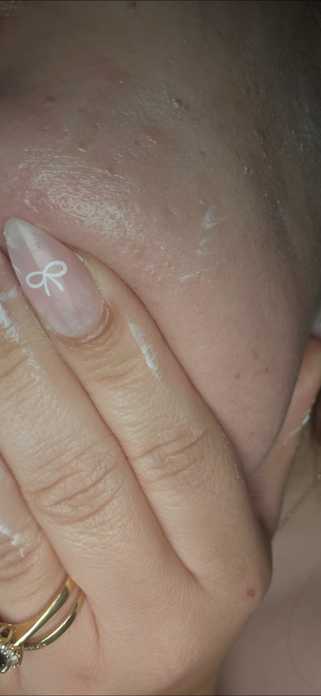 Smoother skin 🥰