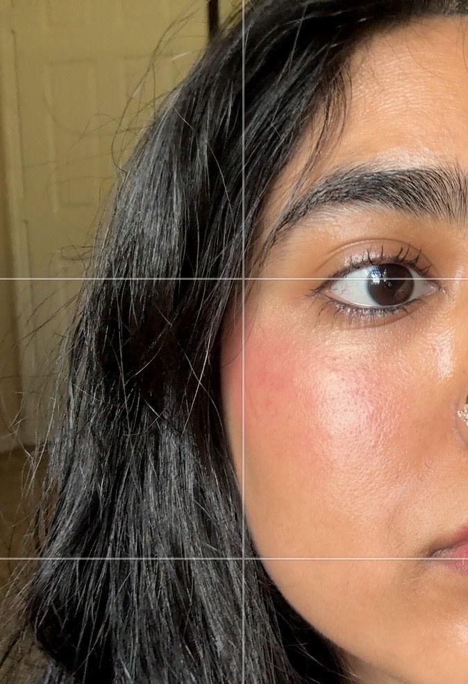 PIGMENTED