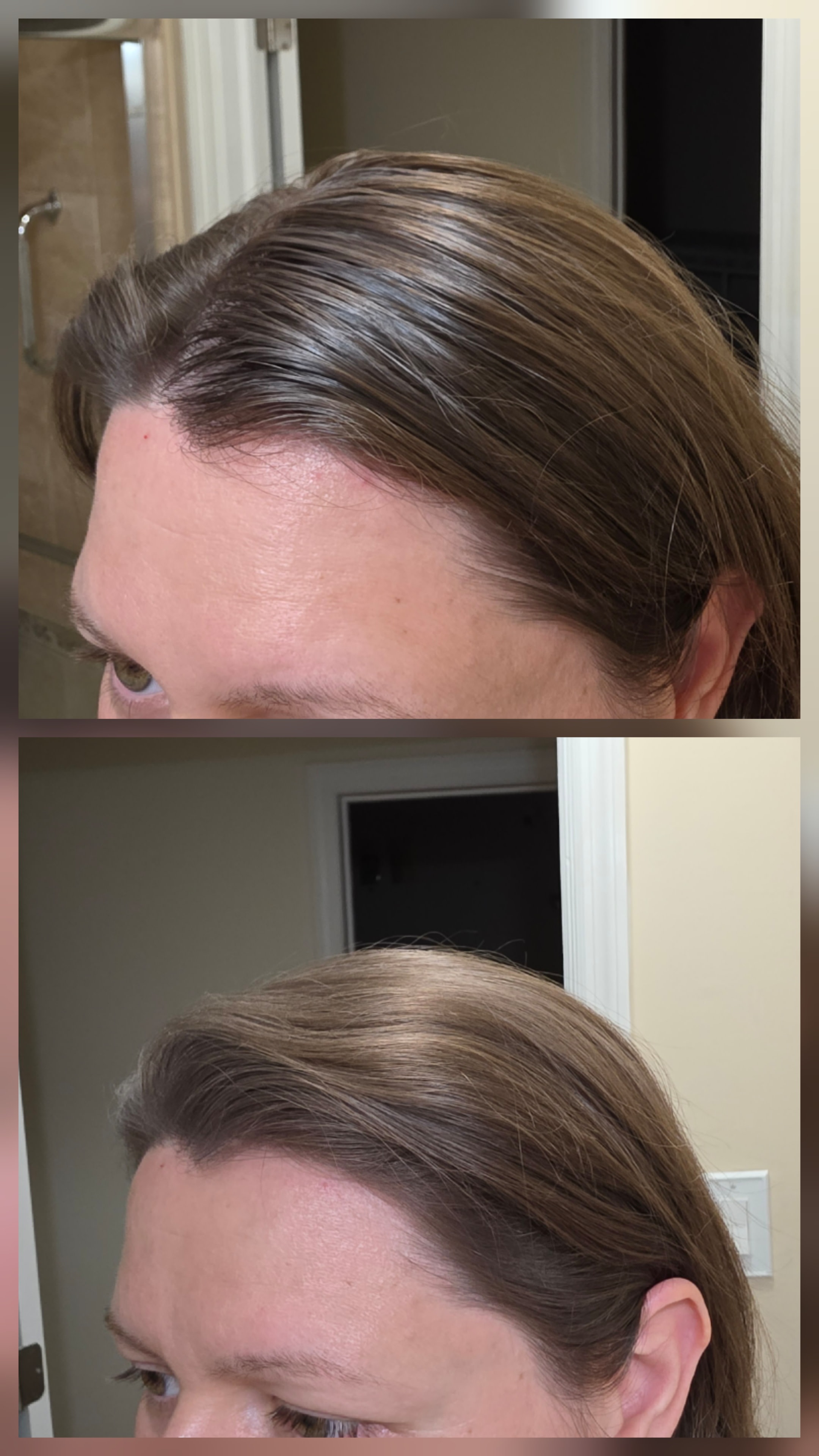 Before/After