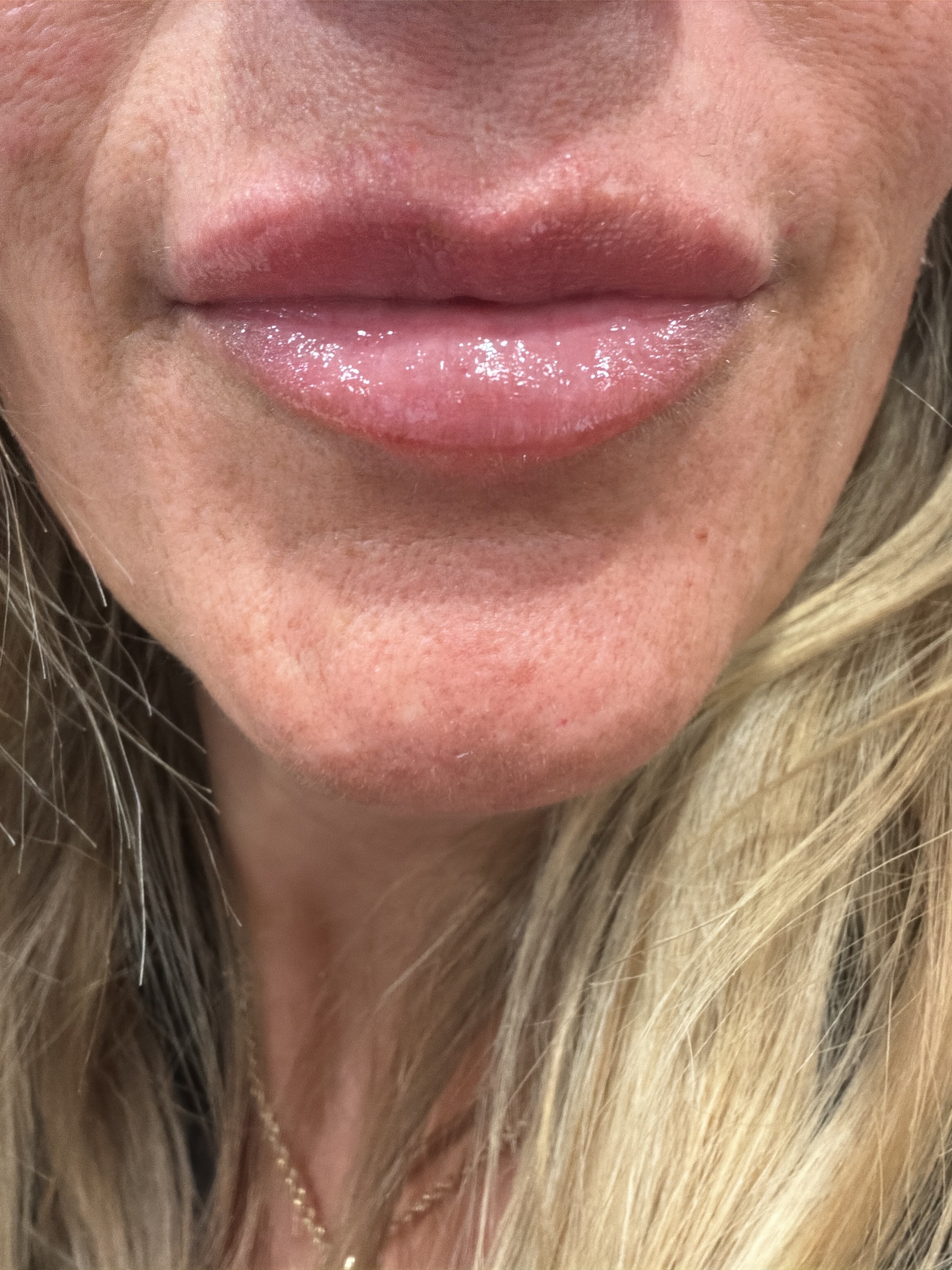 Lip gloss