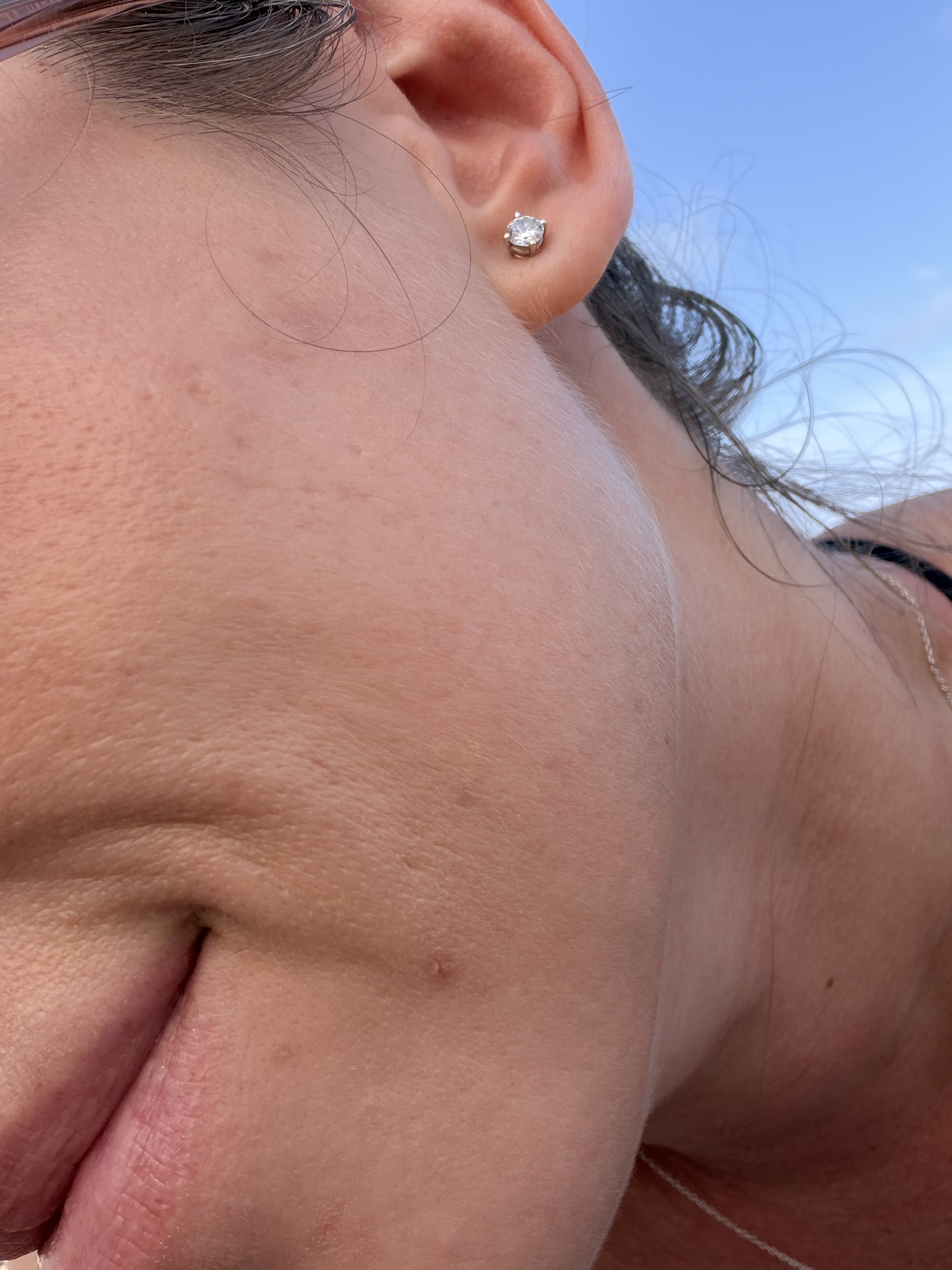 Mi skin