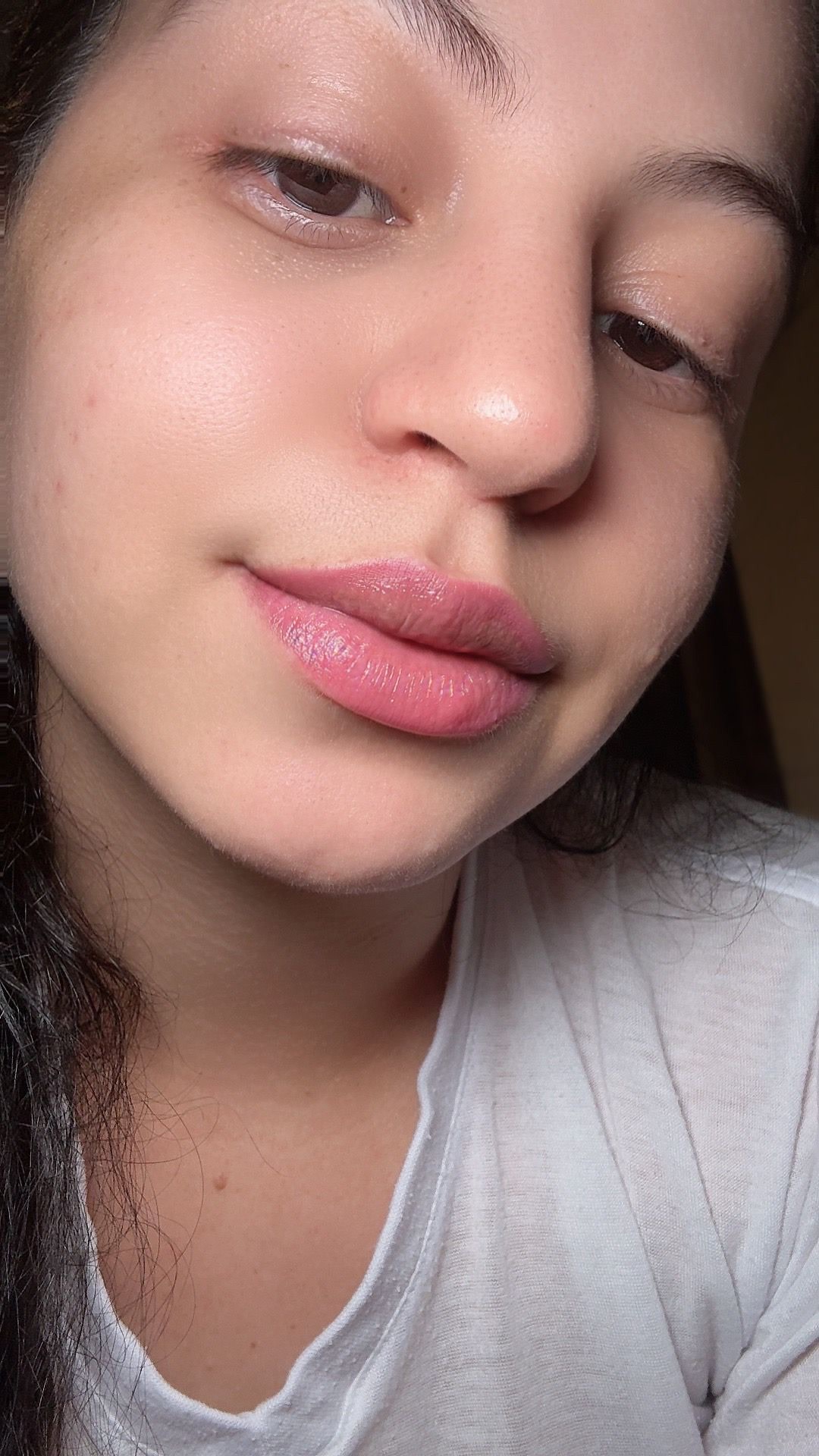 Marked lips