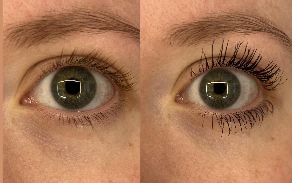 Before and After