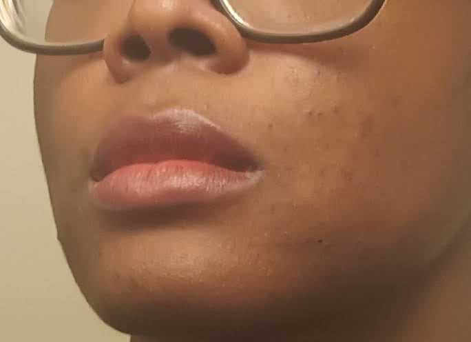 Lip balm