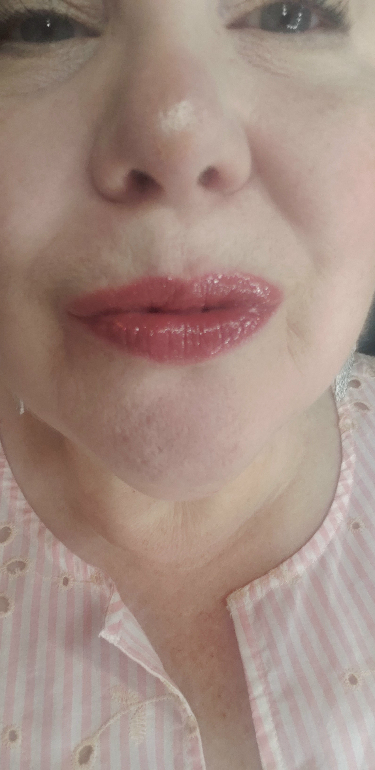 Up close