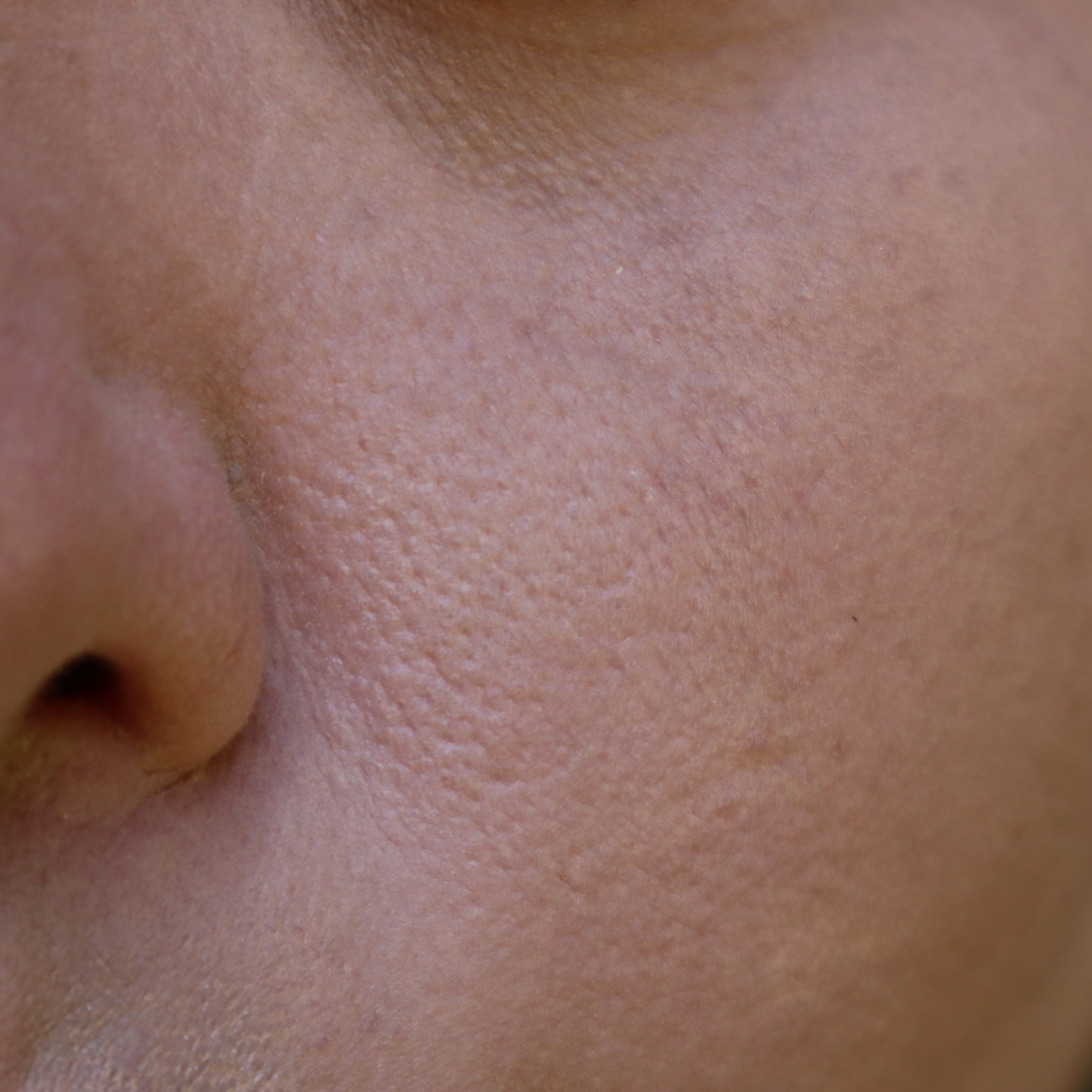 Face with setting powder