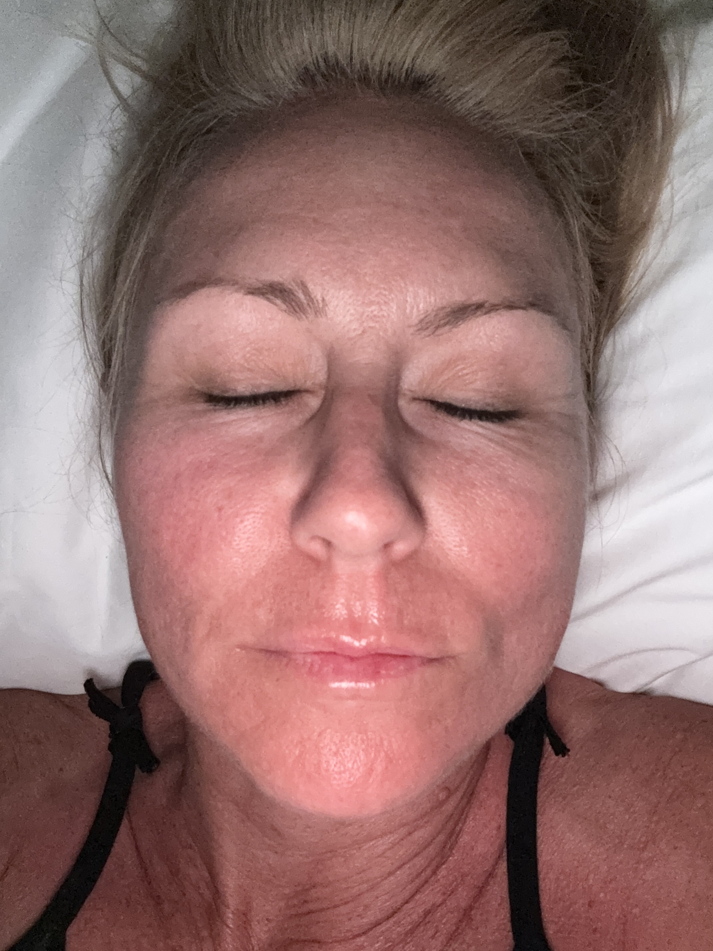 Burnt after depending on the sunscreen
