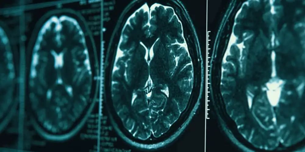 Using Artificial Intelligence in Medical Imaging: A First Step Tutorial ...