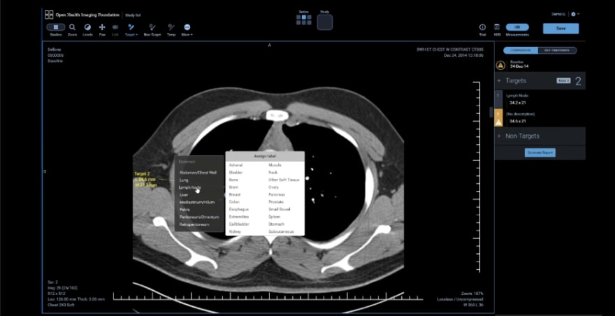 Example lesion labeling workflow