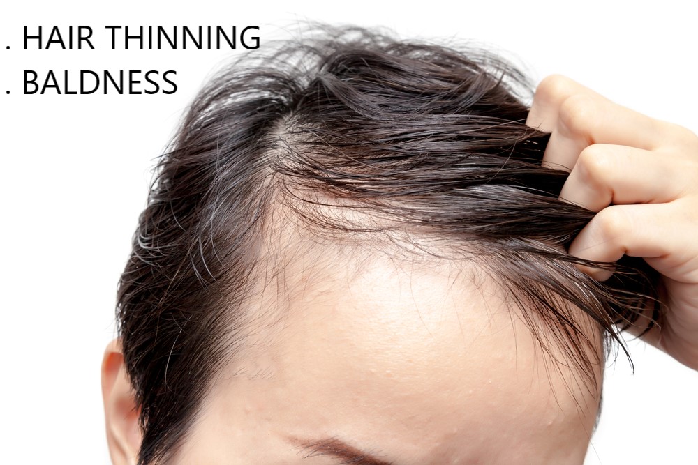 Sai Cosmetics  Hair Transplant Pune  Hair Treatment