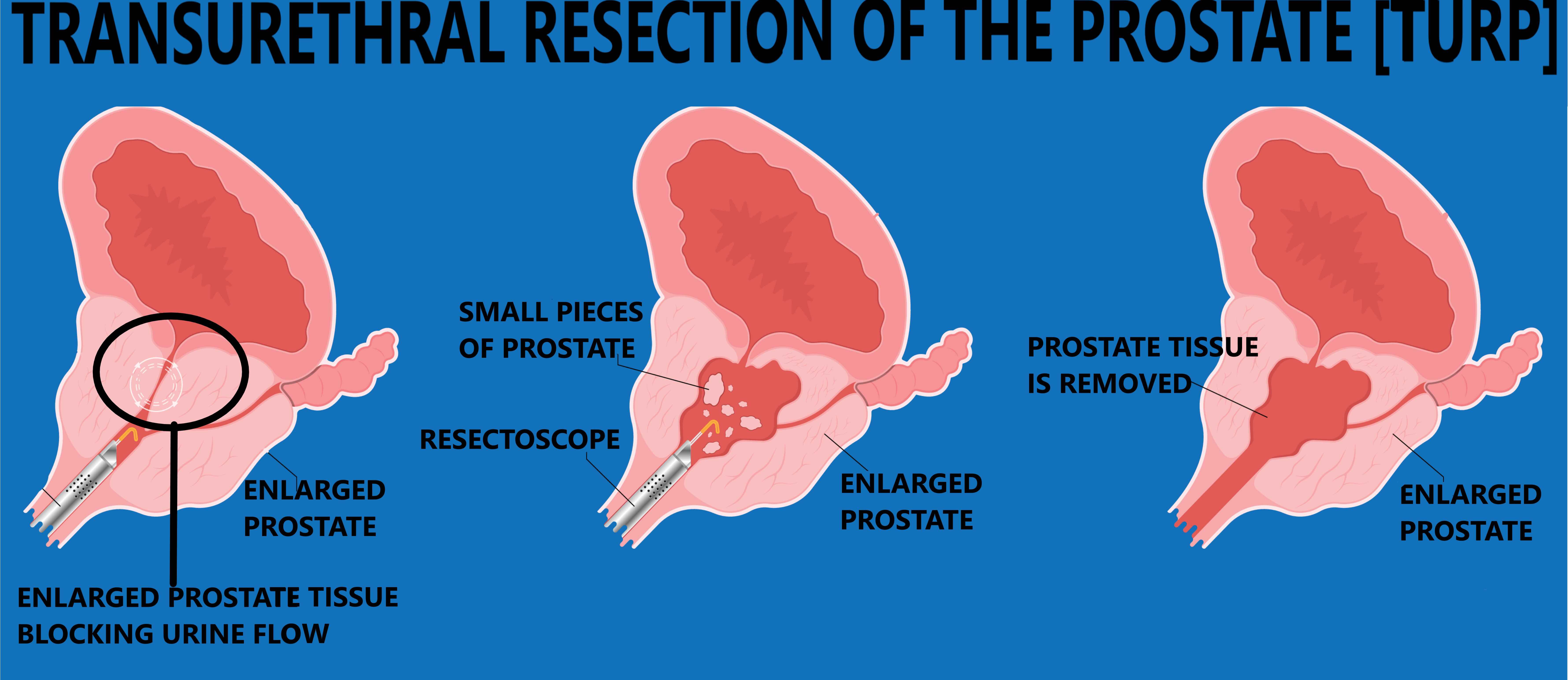 Qora odamning eshagidagi uzun sik