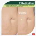 Vitacilina 0.350 G/100 000Ui Ungüento Con 28 Gr