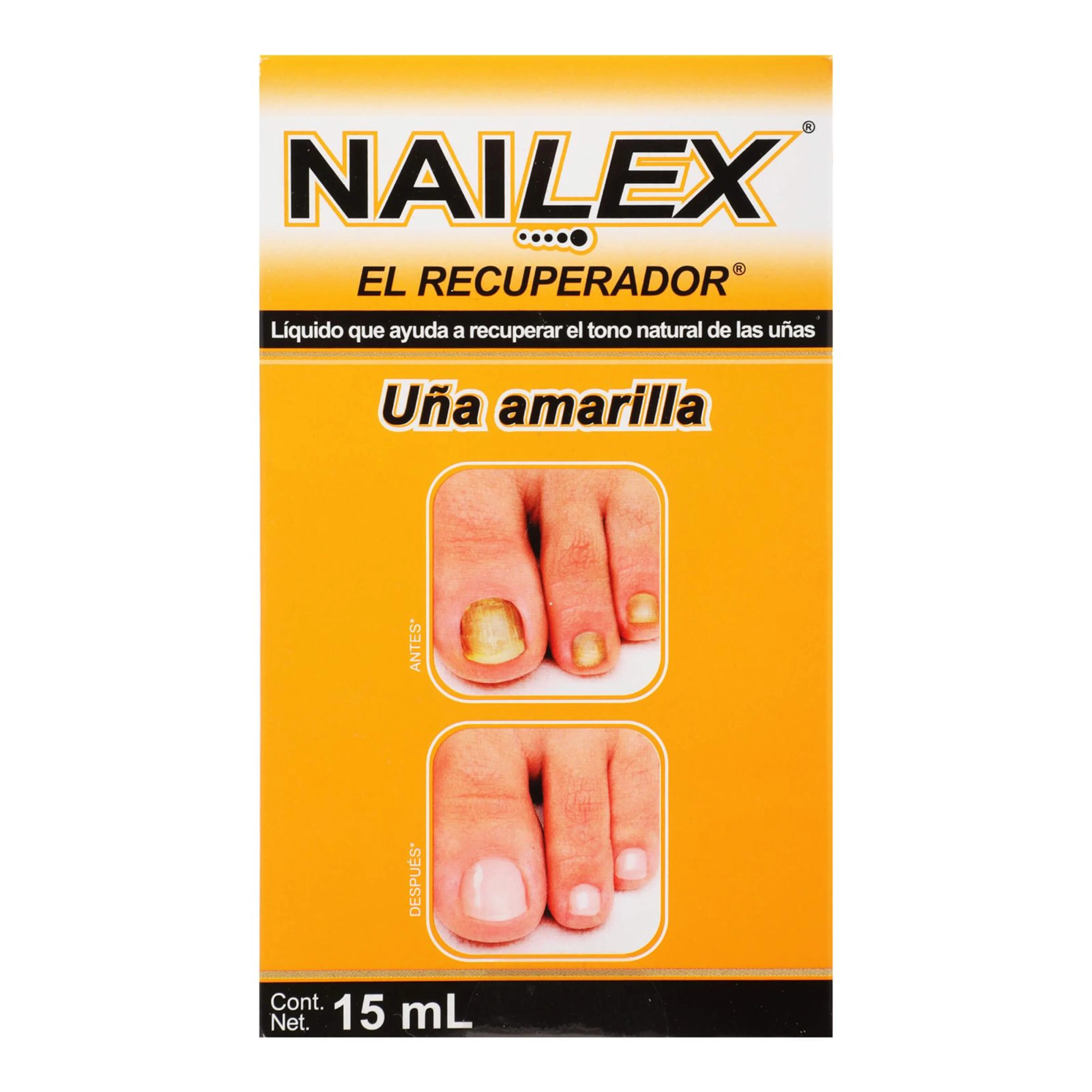 Nailex Recuperador De Tono Para Uña Amarilla 15 Ml