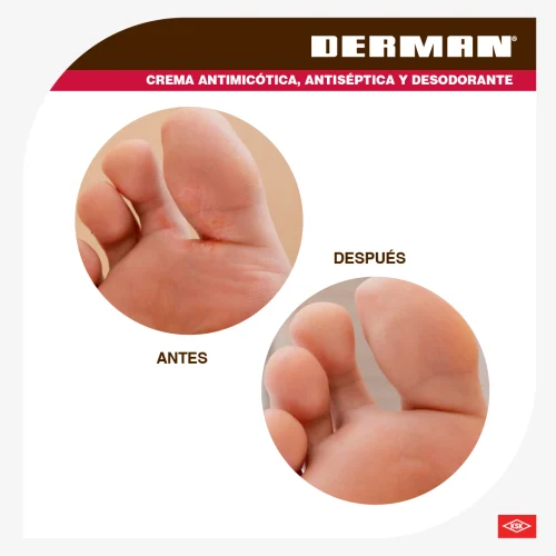 Derman 20.36/100 G Crema Con 25 G