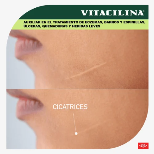 Vitacilina 0.350 G/100 000Ui Ungüento Con 28 Gr