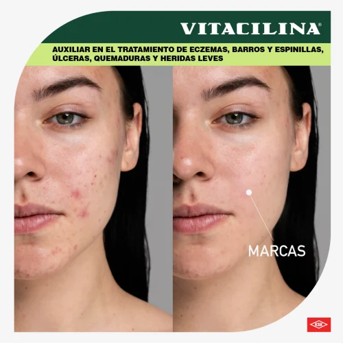 Vitacilina 0.350 G/100 000Ui Ungüento Con 28 Gr