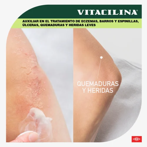Vitacilina 0.350 G/100 000Ui Ungüento Con 28 Gr