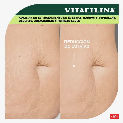 Vitacilina 0.350 G/100 000Ui Ungüento Con 28 Gr