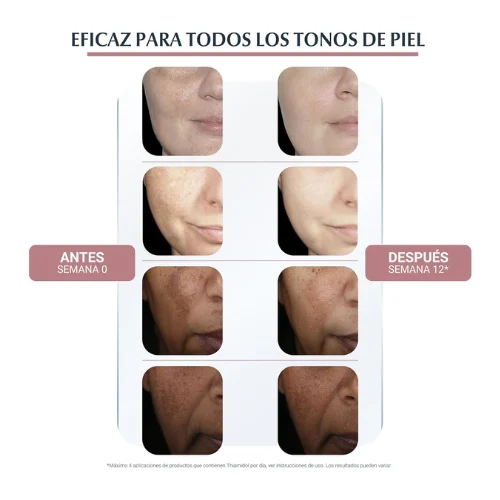 Eucerin Anti-Pigment Dual Serum Facial 30 Ml