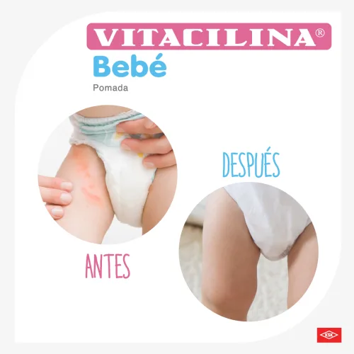 Vitacilina Bebé Pomada Con 110 Gr