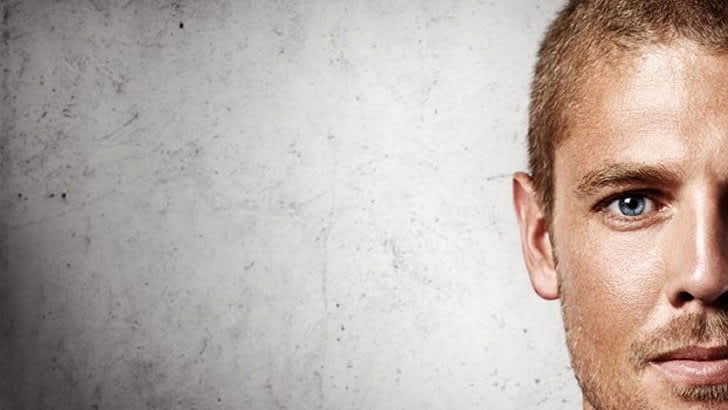 Saçı Dökülen Erkeklere Kötü Haber