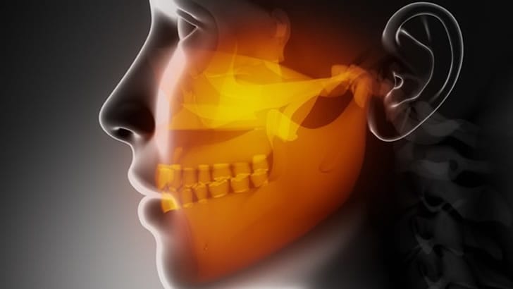 Çene Rahatsızlığını Ciddiye Almamız Gerekiyor!