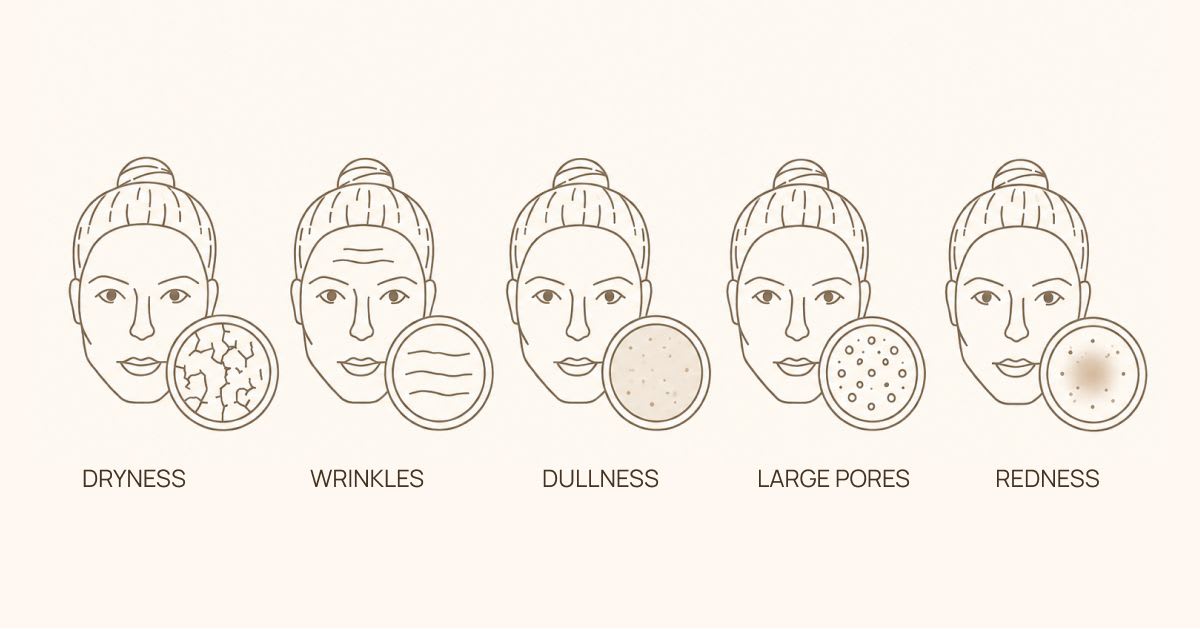 skin-concerns.jpg