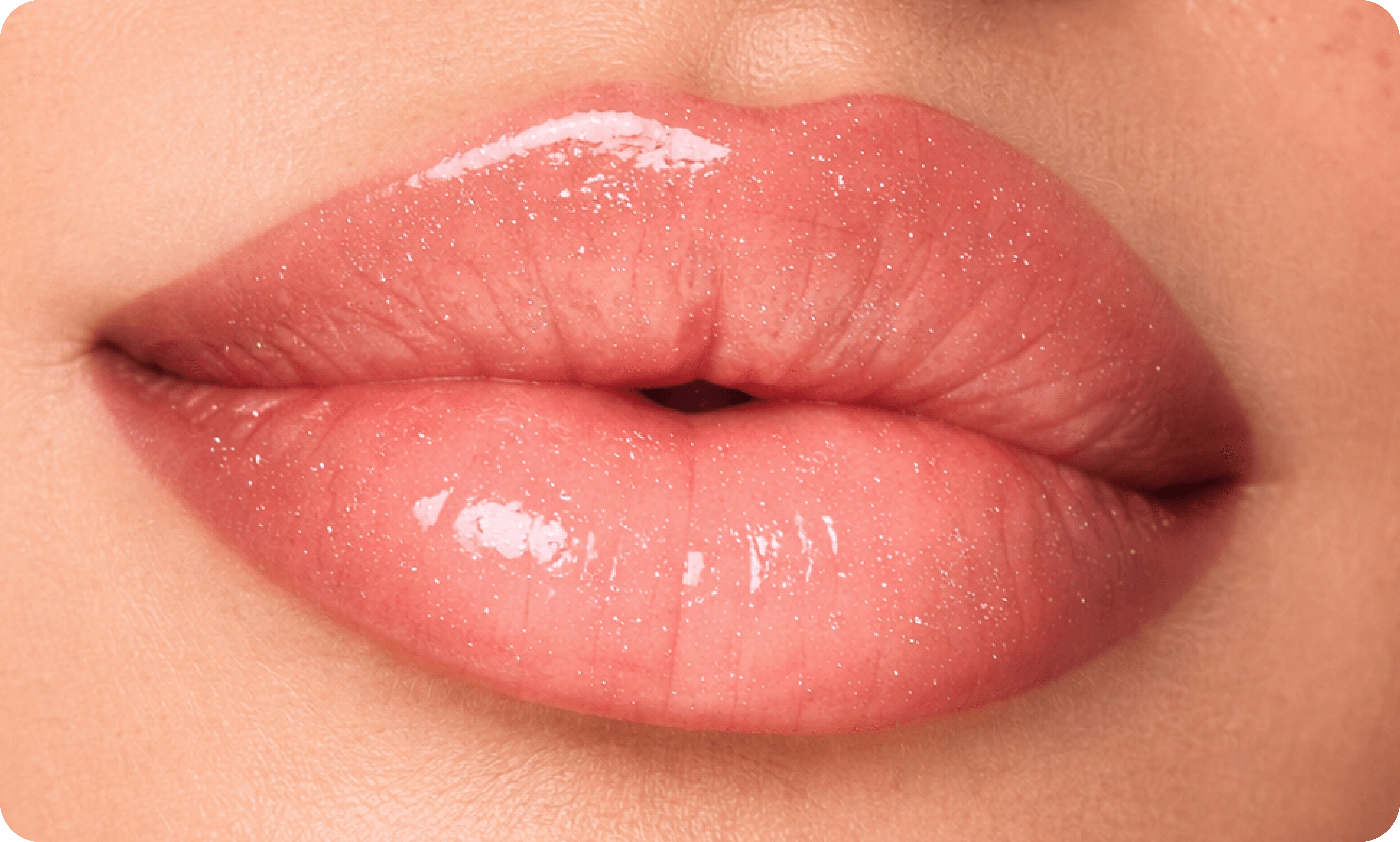 Frame 2087329079.png